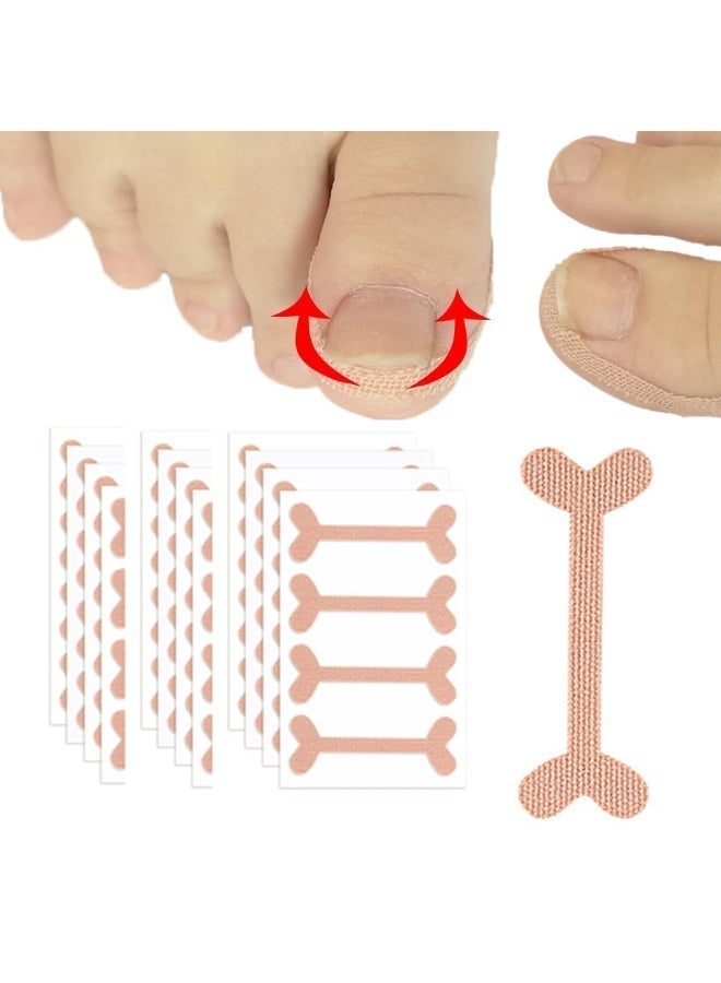 Peachjoy 52pcs Ingrown Toenail Treatment, Ingrown Toenail Corrector Patches, Health Toenail Correction Stickers, Professional Glue-Free Toe Nail Treatment Tool, Foot care - Image 1